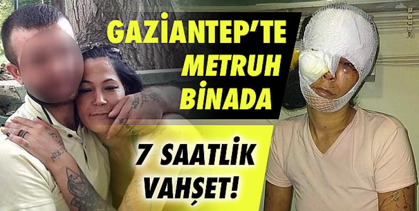 7 saat işkence edilen kadının kafasında 4 şişe kırıldı!