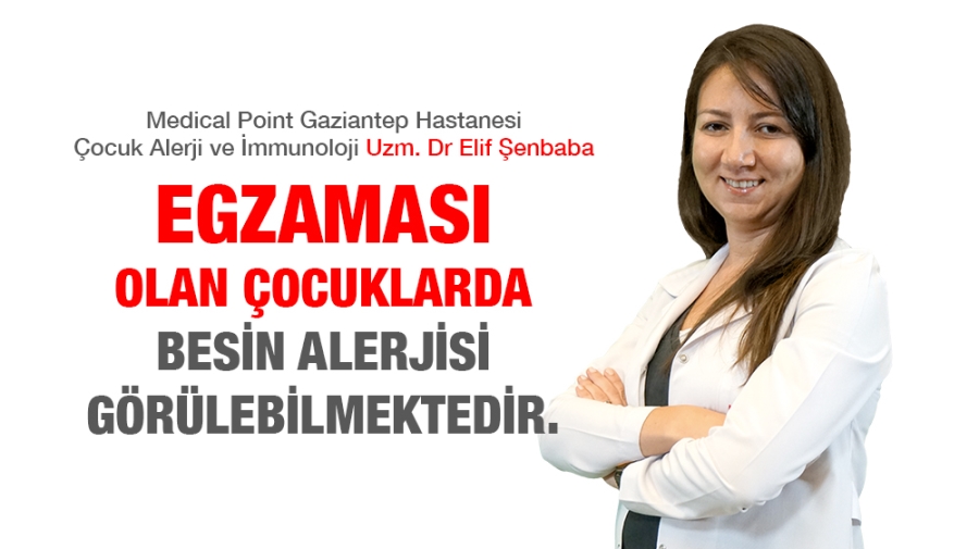 EGZAMASI OLAN ÇOCUKLARDA BESİN ALERJİSİ GÖRÜLEBİLMEKTEDİR.