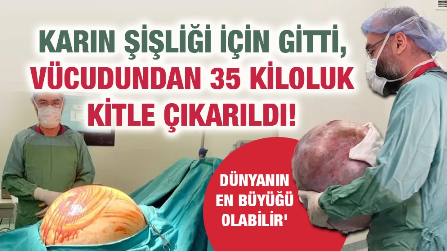 Karın şişliği için gitti, vücudundan 35 kiloluk kitle çıkarıldı!