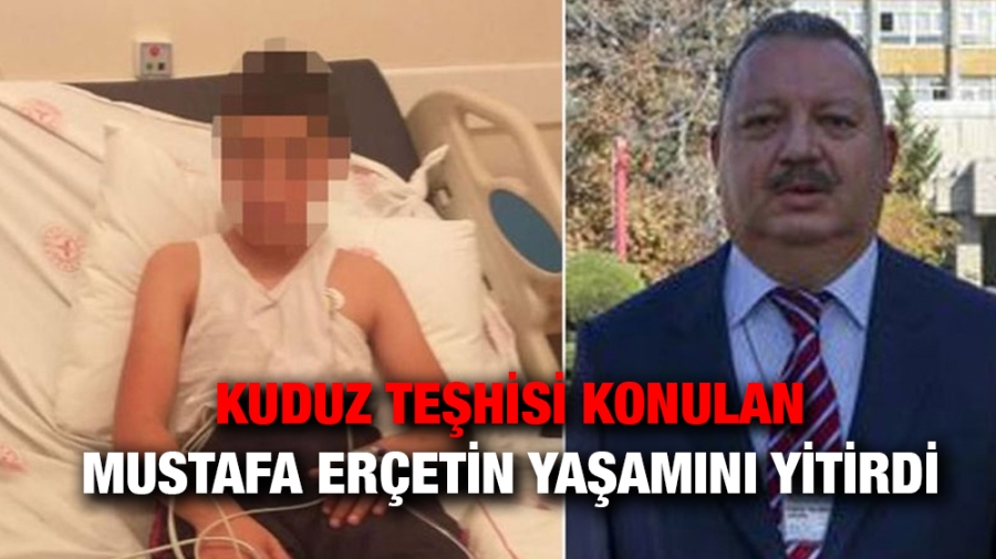 Kuduz teşhisi konulan Mustafa Erçetin yaşamını yitirdi