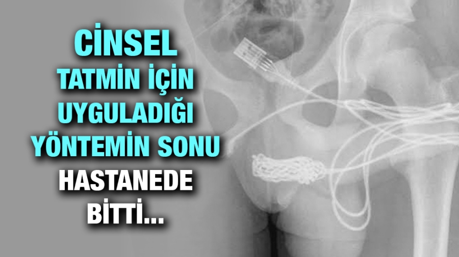 Cinsel tatmin için uyguladığı yöntemin sonu hastanede bitti