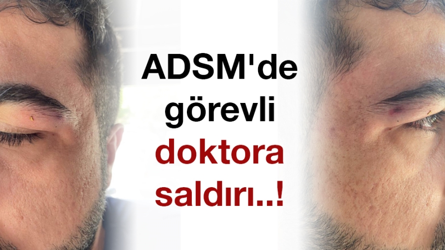 ADSM