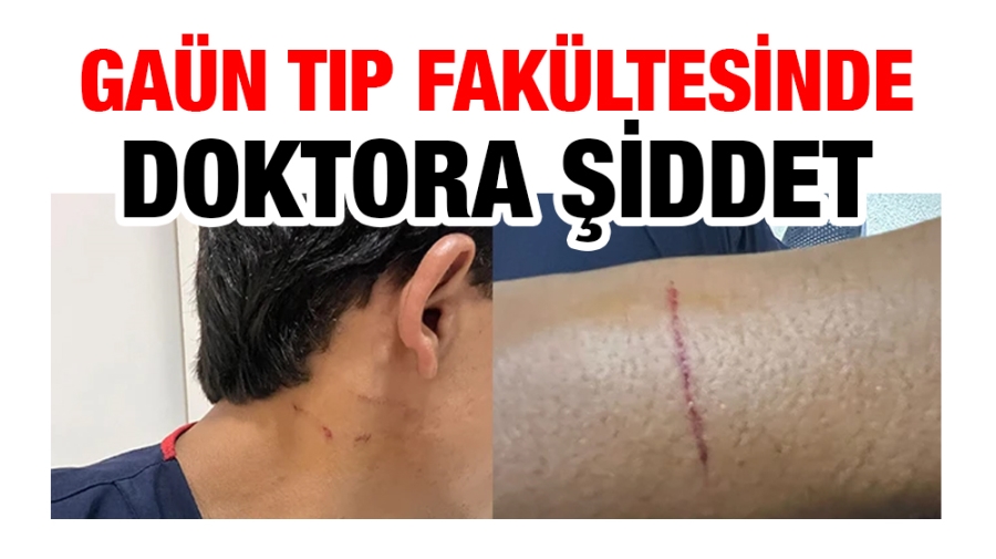 GAÜN Tıp Fakültesinde Doktora Şiddet!