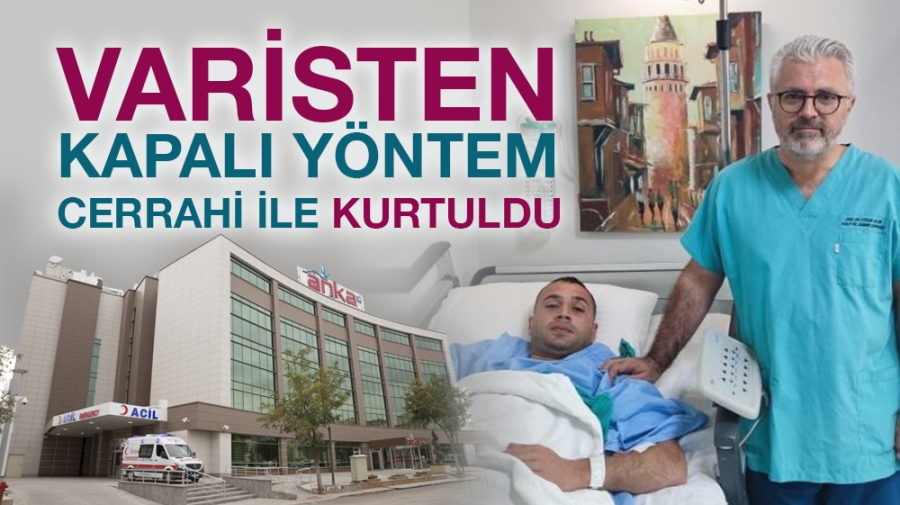 VARİSTEN KAPALI YÖNTEM CERRAHİ İLE KURTULDU