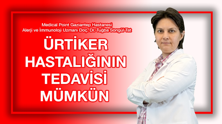 Ürtiker Hastalığının Tedavisi Mümkün