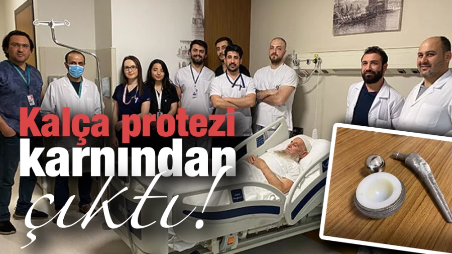 Kalça protezi karnından çıktı!