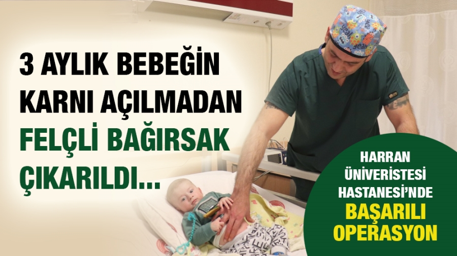 3 AYLIK BEBEĞİN KARNI AÇILMADAN FELÇLİ BAĞIRSAK ÇIKARILDI