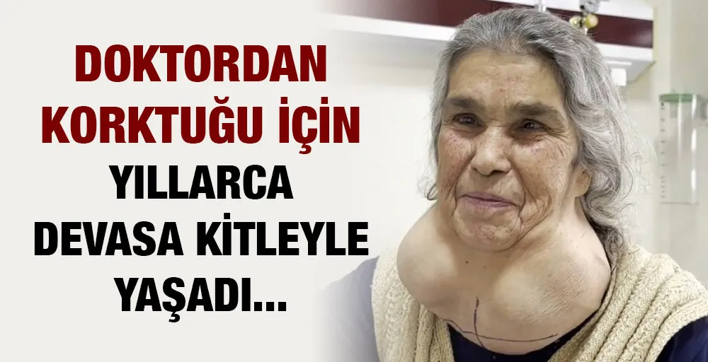 Doktordan korktuğu için yıllarca devasa kitleyle yaşadı