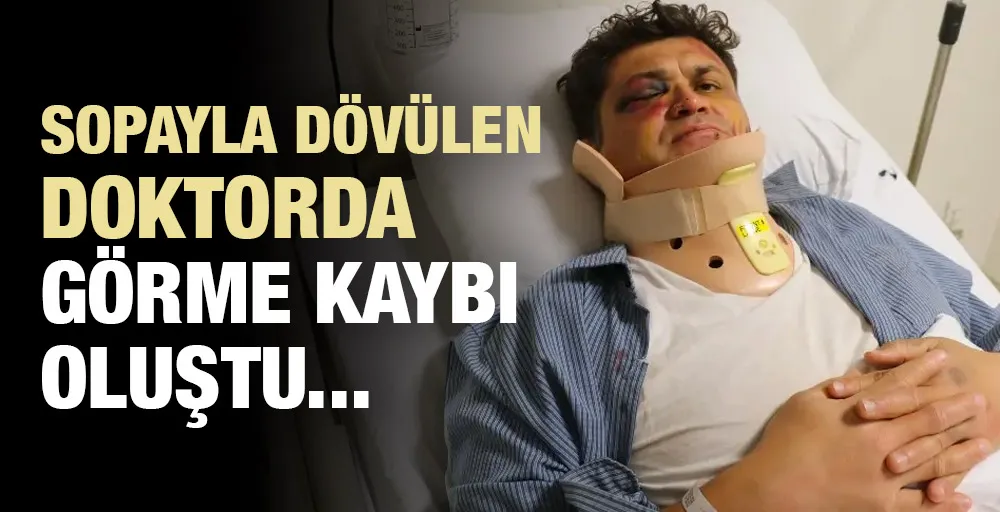 Sopayla dövülen doktorda görme kaybı oluştu