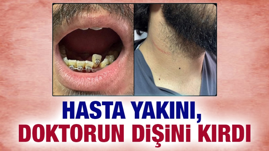 Hasta yakını, doktorun dişini kırdı