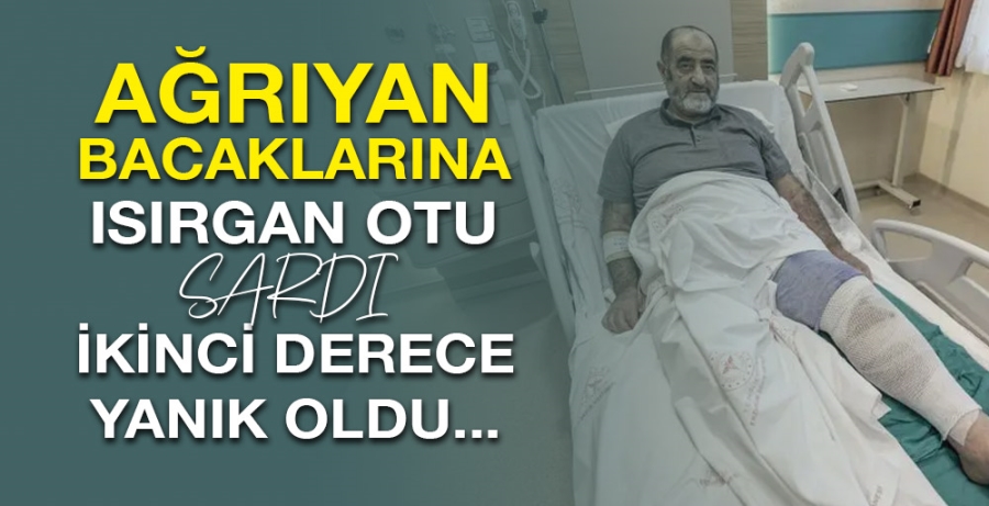 Ağrıyan bacaklarına ısırgan otu sardı, ikinci derece yanık oldu