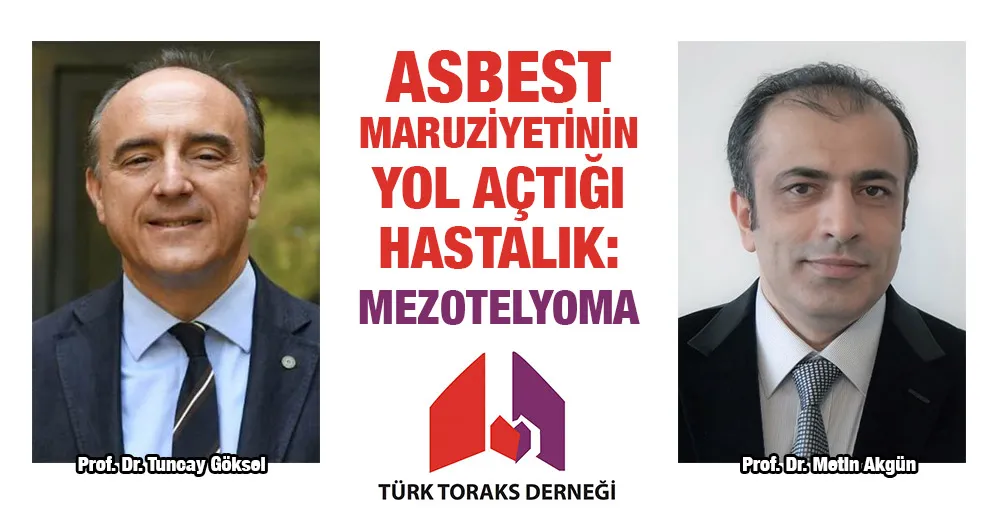 ASBEST MARUZİYETİNİN YOL AÇTIĞI HASTALIK: MEZOTELYOMA