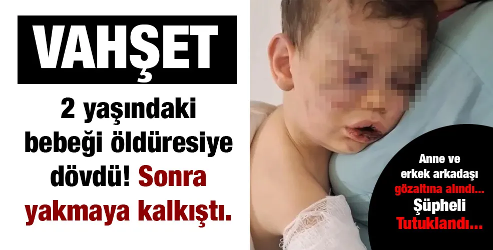 2 yaşındaki bebeği öldüresiye dövdü! Sonra yakmaya kalkıştı.
