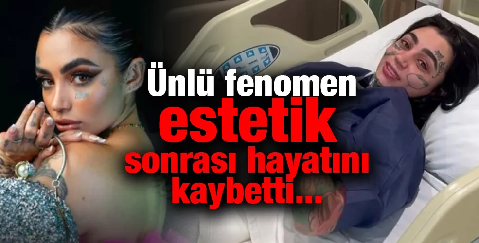 Ünlü fenomen estetik sonrası hayatını kaybetti...