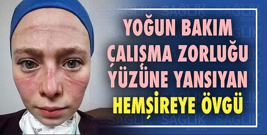 Yoğun bakım çalışma zorluğu yüzüne yansıyan Seher hemşireye övgü