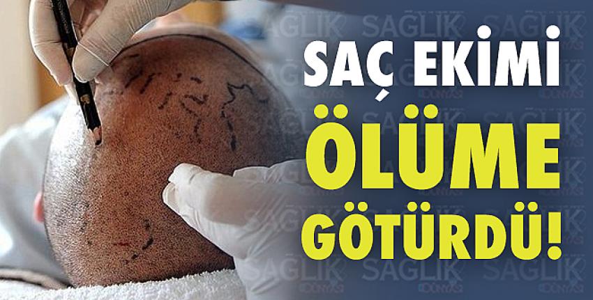 Saç ekimi ölüme götürdü!