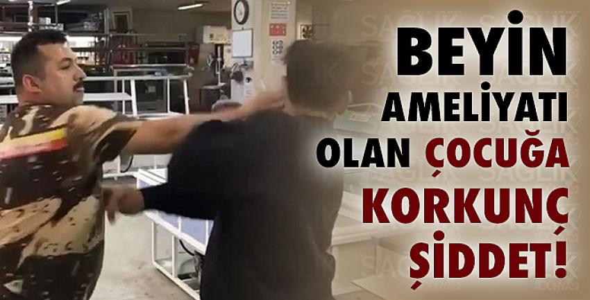 Beyin ameliyatı olan çocuğa korkunç şiddet!