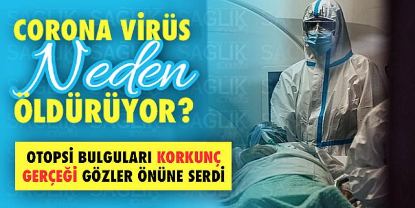 Corona virüs neden öldürüyor?