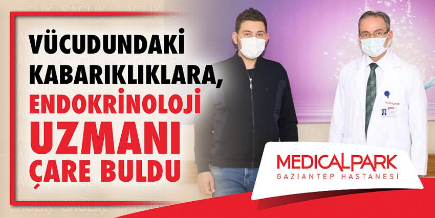 Vücudundaki Kabarıklıklara, Endokrinoloji Uzmanı Çare Buldu.