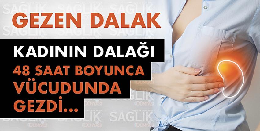 Gezen Dalak...Kadının dalağı 48 saat boyunca vücudunda gezdi