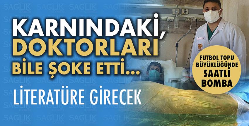 Karnındaki, doktorları bile şoke etti… 