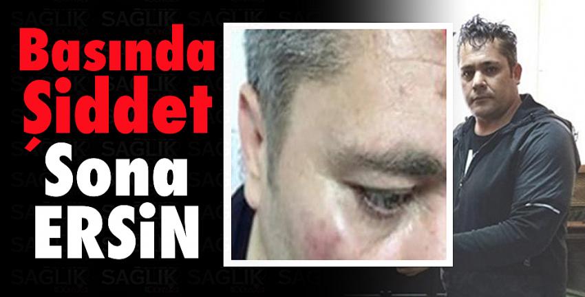 Basında şiddet sona ERSİN!