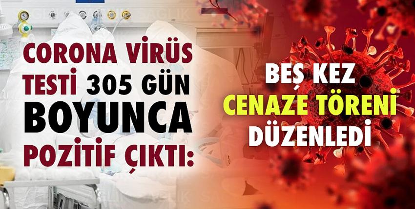 Corona virüs testi 305 gün boyunca pozitif çıktı!
