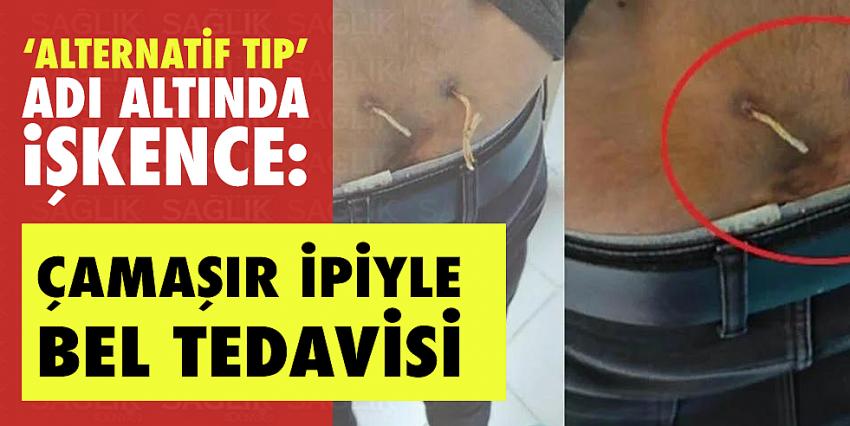 ‘Alternatif tıp’ adı altında işkence: Çamaşır ipiyle bel tedavisi