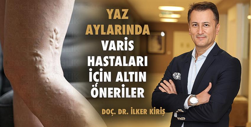 Yaz Aylarında Varis Hastaları İçin Altın Öneriler