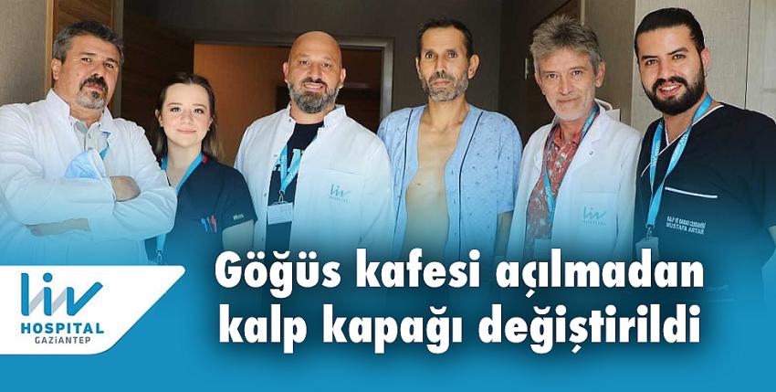 Göğüs kafesi açılmadan kalp kapağı değiştirildi