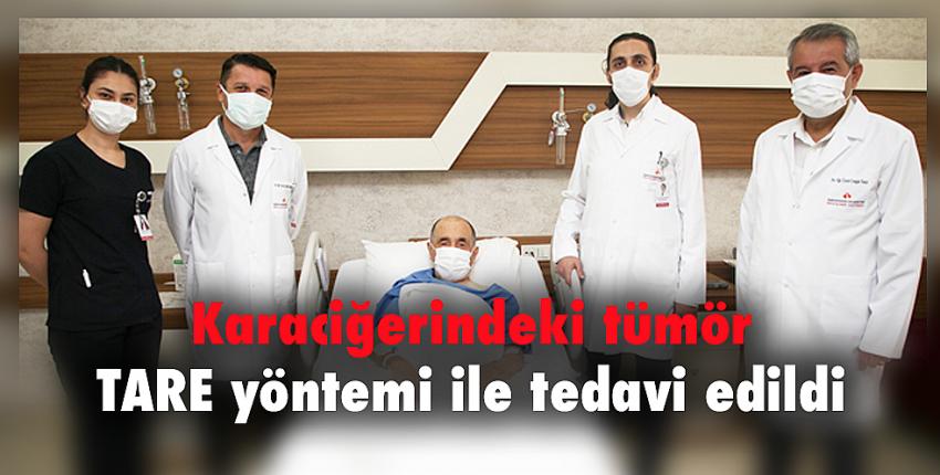 Karaciğerindeki tümör TARE yöntemi ile tedavi edildi