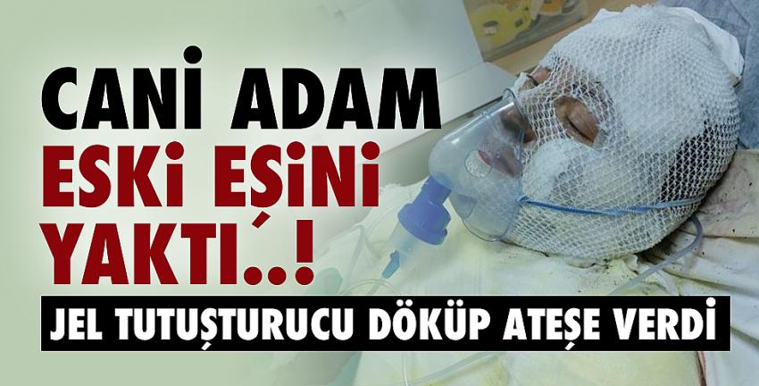 Cani adam eski eşini yaktı!