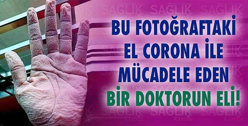 Bu fotoğraftaki el Corona ile mücadele eden bir doktorun eli!